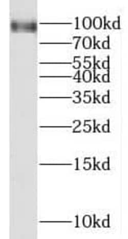 MGAT5B Antibody - BSA Free, Novus Biologicals 100 &mu;g | Buy Online | Novus Biologicals | Fisher Scientific