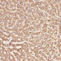 MGAT2 Antibody - BSA Free, Novus Biologicals 100 &mu;g | Buy Online | Novus Biologicals | Fisher Scientific