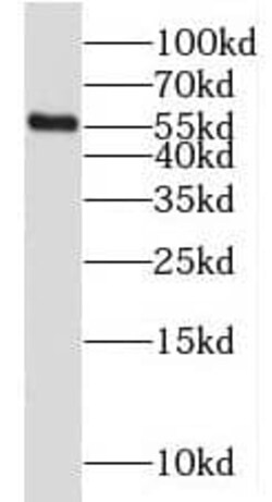 MGAT2 Antibody - BSA Free, Novus Biologicals 100 &mu;g | Buy Online | Novus Biologicals | Fisher Scientific