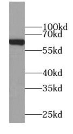 MFSD2 Antibody - BSA Free, Novus Biologicals 100 &mu;g | Buy Online | Novus Biologicals | Fisher Scientific