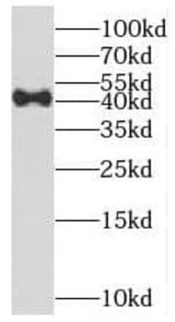 methyltransferase like 9 Antibody - BSA Free, Novus Biologicals 100 &mu;g | Buy Online | Novus Biologicals | Fisher Scientific
