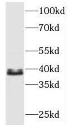 MBNL3 Antibody - BSA Free, Novus Biologicals 100 &mu;g | Buy Online | Novus Biologicals | Fisher Scientific