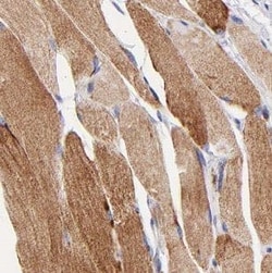MBNL3 Antibody - BSA Free, Novus Biologicals 100 &mu;g | Buy Online | Novus Biologicals | Fisher Scientific