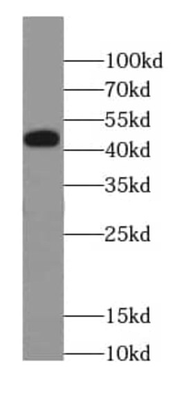Cav1.2 Antibody - BSA Free, Novus Biologicals 100 &mu;g | Buy Online | Novus Biologicals | Fisher Scientific