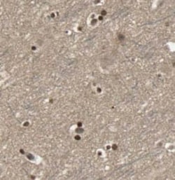 Cav1.2 Antibody - BSA Free, Novus Biologicals 100 &mu;g | Buy Online | Novus Biologicals | Fisher Scientific