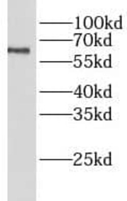 LIPC Antibody - BSA Free, Novus Biologicals 100 &mu;g | Buy Online | Novus Biologicals | Fisher Scientific