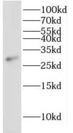 IDI2 Antibody - BSA Free, Novus Biologicals 100 &mu;g | Buy Online | Novus Biologicals | Fisher Scientific