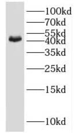 IDH3G Antibody - BSA Free, Novus Biologicals 100 &mu;g | Buy Online | Novus Biologicals | Fisher Scientific