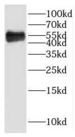 htrA4 Antibody - BSA Free, Novus Biologicals 100 &mu;g | Buy Online | Novus Biologicals | Fisher Scientific