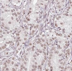 HSBP1 Antibody - BSA Free, Novus Biologicals 100 &mu;g | Buy Online | Novus Biologicals | Fisher Scientific