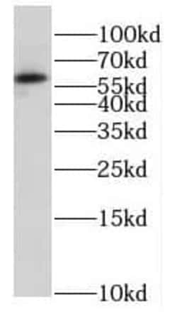 HSBP1 Antibody - BSA Free, Novus Biologicals 100 &mu;g | Buy Online | Novus Biologicals | Fisher Scientific