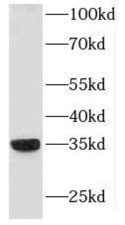HLA DRB4 Antibody - BSA Free, Novus Biologicals 100 &mu;g | Buy Online | Novus Biologicals | Fisher Scientific