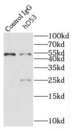 TPD52L1/D53 Antibody - BSA Free, Novus Biologicals 100 &mu;g | Buy Online | Novus Biologicals | Fisher Scientific