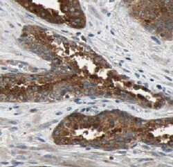 TPD52L1/D53 Antibody - BSA Free, Novus Biologicals 100 &mu;g | Buy Online | Novus Biologicals | Fisher Scientific