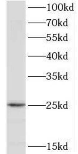 TPD52L1/D53 Antibody - BSA Free, Novus Biologicals 100 &mu;g | Buy Online | Novus Biologicals | Fisher Scientific