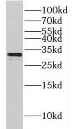 HCCS Antibody - BSA Free, Novus Biologicals 100 &mu;g | Buy Online | Novus Biologicals | Fisher Scientific