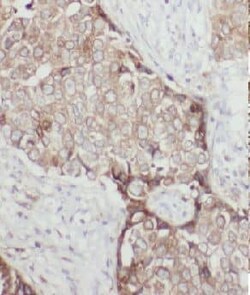 GTPBP3 Antibody - BSA Free, Novus Biologicals 100 &mu;g | Buy Online | Novus Biologicals | Fisher Scientific