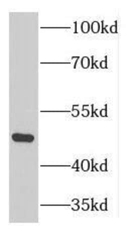 GTPBP3 Antibody - BSA Free, Novus Biologicals 100 &mu;g | Buy Online | Novus Biologicals | Fisher Scientific