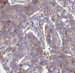 GPSM2 Antibody - BSA Free, Novus Biologicals 100 &mu;g | Buy Online | Novus Biologicals | Fisher Scientific