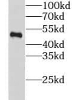 GPR137 Antibody - BSA Free, Novus Biologicals 100 &mu;g | Buy Online | Novus Biologicals | Fisher Scientific