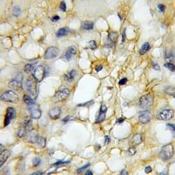 GPR137 Antibody - BSA Free, Novus Biologicals 100 &mu;g | Buy Online | Novus Biologicals | Fisher Scientific