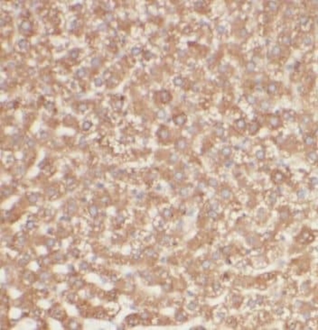 GGCX Antibody - BSA Free, Novus Biologicals 100 μg | Buy Online | Novus ...