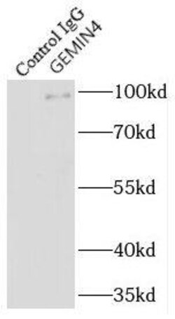Gemin 4 Antibody - BSA Free, Novus Biologicals 100 &mu;g | Buy Online | Novus Biologicals | Fisher Scientific