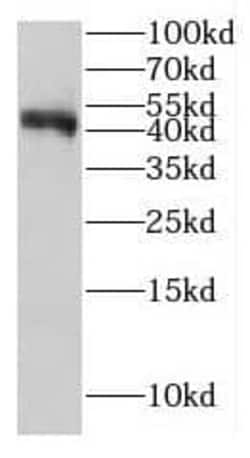 GCAT Antibody - BSA Free, Novus Biologicals 100 &mu;g | Buy Online | Novus Biologicals | Fisher Scientific