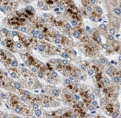 GATC Antibody - BSA Free, Novus Biologicals 100 &mu;g | Buy Online | Novus Biologicals | Fisher Scientific