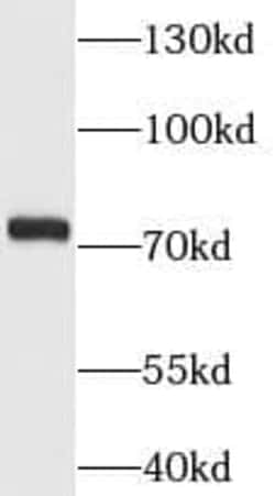 MCM3AP Antibody - BSA Free, Novus Biologicals 100 &mu;g | Buy Online | Novus Biologicals | Fisher Scientific