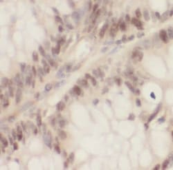 MCM3AP Antibody - BSA Free, Novus Biologicals 100 &mu;g | Buy Online | Novus Biologicals | Fisher Scientific