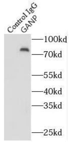 MCM3AP Antibody - BSA Free, Novus Biologicals 100 &mu;g | Buy Online | Novus Biologicals | Fisher Scientific