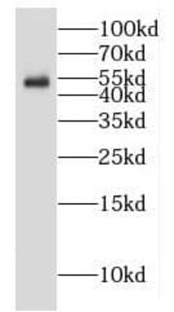 GALNTL5 Antibody - BSA Free, Novus Biologicals 100 &mu;g | Buy Online | Novus Biologicals | Fisher Scientific