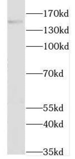 GAK Antibody - BSA Free, Novus Biologicals 100 &mu;g | Buy Online | Novus Biologicals | Fisher Scientific