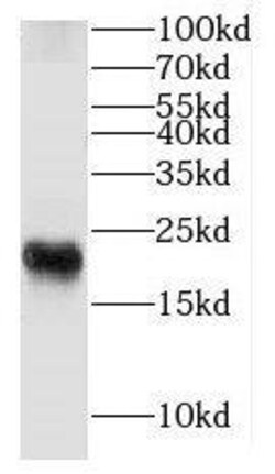 FXYD7 Antibody - BSA Free, Novus Biologicals 100 &mu;g | Buy Online | Novus Biologicals | Fisher Scientific