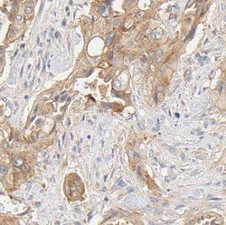 FXYD2 Antibody - BSA Free, Novus Biologicals 100 &mu;g | Buy Online | Novus Biologicals | Fisher Scientific