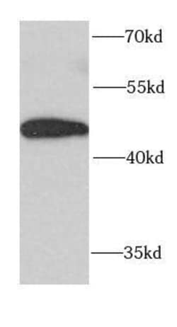 FUT6 Antibody - BSA Free, Novus Biologicals 100 &mu;g | Buy Online | Novus Biologicals | Fisher Scientific