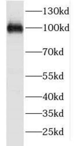 FSD2 Antibody - BSA Free, Novus Biologicals 100 &mu;g | Buy Online | Novus Biologicals | Fisher Scientific