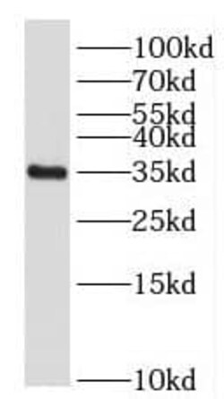 FOXS1 Antibody - BSA Free, Novus Biologicals 100 &mu;g | Buy Online | Novus Biologicals | Fisher Scientific