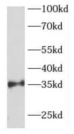 FOXR1 Antibody - BSA Free, Novus Biologicals 100 &mu;g | Buy Online | Novus Biologicals | Fisher Scientific