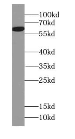 FMO5 Antibody - BSA Free, Novus Biologicals 100 &mu;g | Buy Online | Novus Biologicals | Fisher Scientific