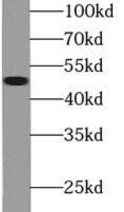 FMO2 Antibody - BSA Free, Novus Biologicals 100 &mu;g | Buy Online | Novus Biologicals | Fisher Scientific