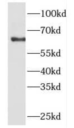 FKBP9 Antibody - BSA Free, Novus Biologicals 100 &mu;g | Buy Online | Novus Biologicals | Fisher Scientific