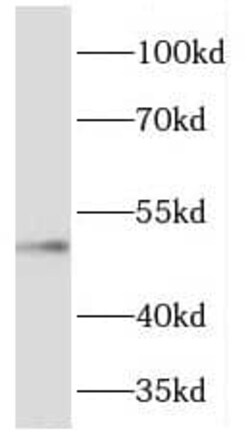 FJX1 Antibody - BSA Free, Novus Biologicals 100 &mu;g | Buy Online | Novus Biologicals | Fisher Scientific