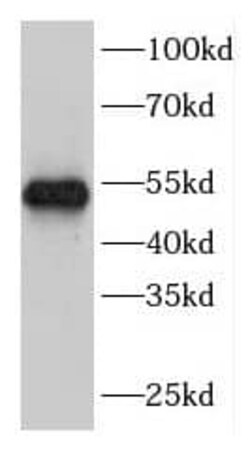 FBXW2 Antibody - BSA Free, Novus Biologicals 100 &mu;g | Buy Online | Novus Biologicals | Fisher Scientific