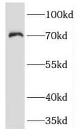 Kv1.2 Antibody - BSA Free, Novus Biologicals 100 &mu;g | Buy Online | Novus Biologicals | Fisher Scientific