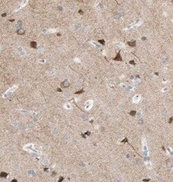 KLC2 Antibody - BSA Free, Novus Biologicals 100 &mu;g | Buy Online | Novus Biologicals | Fisher Scientific