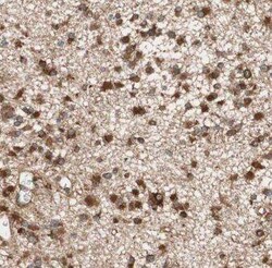 Kif3c Antibody - BSA Free, Novus Biologicals 100 &mu;g | Buy Online | Novus Biologicals | Fisher Scientific