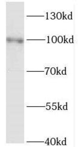Kif3c Antibody - BSA Free, Novus Biologicals 100 &mu;g | Buy Online | Novus Biologicals | Fisher Scientific