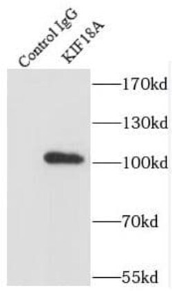 KIF18A Antibody - BSA Free, Novus Biologicals 100 &mu;g | Buy Online | Novus Biologicals | Fisher Scientific